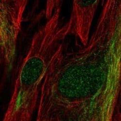 TCF19 Rabbit anti-Human, Polyclonal, Novus Biologicals 100 &mu;g; Unconjugated:Antibodies,