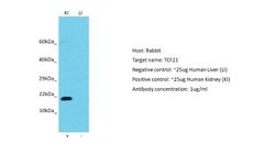 TCF21 Rabbit anti-Human, Polyclonal, Novus Biologicals 0.1 mL | Buy Online | Novus Biologicals | Fisher Scientific