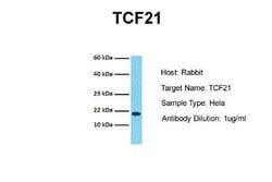 TCF21 Rabbit anti-Human, Polyclonal, Novus Biologicals 0.1 mL | Buy Online | Novus Biologicals | Fisher Scientific