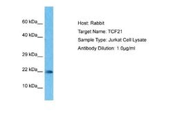 TCF21 Rabbit anti-Human, Polyclonal, Novus Biologicals 0.1 mL | Buy Online | Novus Biologicals | Fisher Scientific