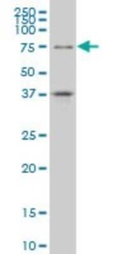 TCF4 Antibody (3E10), Novus Biologicals 0.1 mg, Unconjugated:Antibodies
