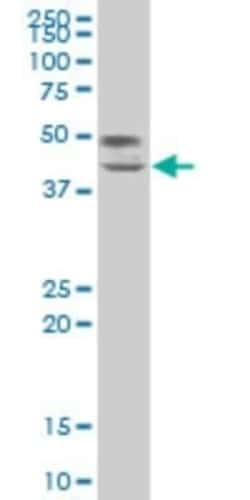 TCF7/TCF1 Antibody (2E9), Novus Biologicals 0.1 mg, Unconjugated:Anticorps,