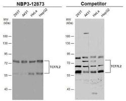 TCF7L2 Antibody, Novus Biologicals 100 &mu;g | Buy Online | Novus Biologicals | Fisher Scientific