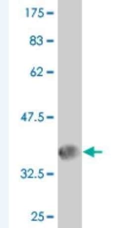 TCIRG1 Antibody (6H3), Novus Biologicals 100 &mu;g | Buy Online | Novus Biologicals | Fisher Scientific