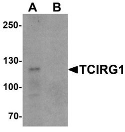 TCIRG1 Antibody - BSA Free, Novus Biologicals 0.1 mg | Buy Online | Novus Biologicals | Fisher Scientific