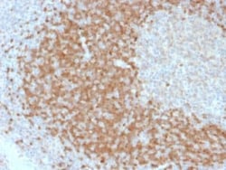 TCL1A Antibody (TCL1/2078), Novus Biologicals 20 &mu;g; Unconjugated:Anticorps,