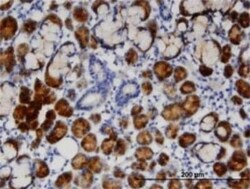 TCN1 Antibody (3F10), Novus Biologicals 0.1 mg | Buy Online | Novus Biologicals | Fisher Scientific