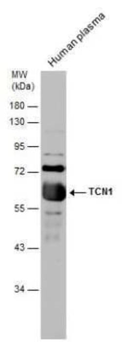 TCN1 Antibody, Novus Biologicals 100 &mu;g | Buy Online | Novus Biologicals | Fisher Scientific