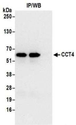 TCP1-delta Antibody, Novus Biologicals 100 &mu;g; Unconjugated:Antibodies,