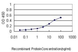 TCP1-eta Antibody (1D6), Novus Biologicals 0.1 mg | Buy Online | Novus Biologicals | Fisher Scientific