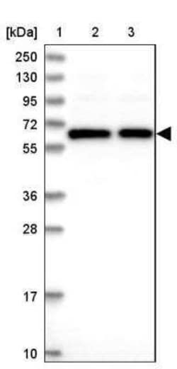 TCP11L2 Antibody, Novus Biologicals 25 &mu;L; Unconjugated:Antibodies,