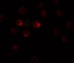 TCTEX1D1 Antibody - BSA Free, Novus Biologicals 0.1 mg | Buy Online | Novus Biologicals | Fisher Scientific