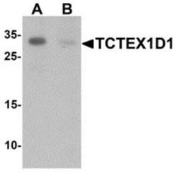 TCTEX1D1 Antibody - BSA Free, Novus Biologicals 0.1 mg | Buy Online | Novus Biologicals | Fisher Scientific