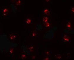 TCTEX1D2 Antibody - BSA Free, Novus Biologicals 0.1 mg; Unconjugated:Antibodies,