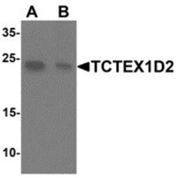 TCTEX1D2 Antibody - BSA Free, Novus Biologicals 0.1 mg; Unconjugated:Antibodies,