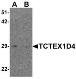TCTEX1D4 Antibody - BSA Free, Novus Biologicals 0.1 mg; Unconjugated:Antibodies,