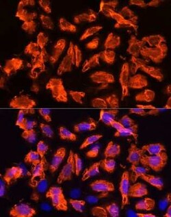 TCTN1 Antibody - Azide and BSA Free, Novus Biologicals:Antibodies:Primary