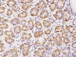 TCTN3 Antibody, Novus Biologicals 100 &mu;g, Unconjugated:Antibodies, Polyclonal