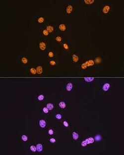 TDP-43/TARDBP Rabbit anti-Human, Mouse, Rat, Clone: 4R5L7, Novus Biologicals 20 &mu;g | Buy Online | Novus Biologicals | Fisher Scientific