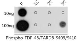 TDP-43/TARDBP Rabbit anti-Human, Polyclonal, Novus Biologicals 100 &mu;g | Buy Online | Novus Biologicals | Fisher Scientific