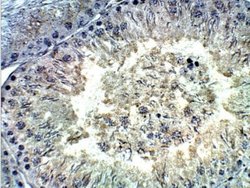 TDRD1 Antibody, Novus Biologicals 0.05 mg; Unconjugated:Antibodies, Polyclonal
