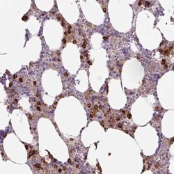 TDRD15 Antibody, Novus Biologicals:Antibodies:Primary Antibodies