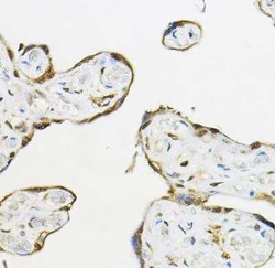 TEAD3 Antibody - BSA Free, Novus Biologicals 0.1 mL, Unconjugated:Antibodies,