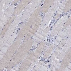 TEKT3 Rabbit anti-Human, Polyclonal, Novus Biologicals 100 &mu;g; Unconjugated:Antibodies,