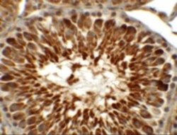 TEKT5 Antibody - BSA Free, Novus Biologicals 0.1 mg; Unconjugated:Antibodies,