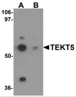 TEKT5 Antibody - BSA Free, Novus Biologicals 0.1 mg; Unconjugated:Antibodies,