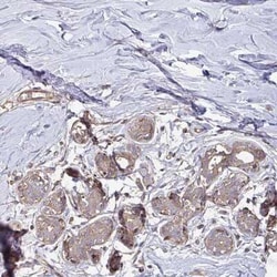 TEM Antibody, Novus Biologicals:Antibodies:Primary Antibodies