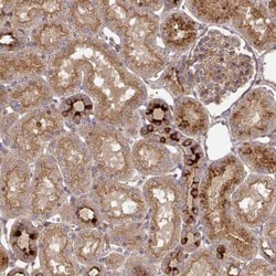 TEM Antibody, Novus Biologicals:Antibodies:Primary Antibodies