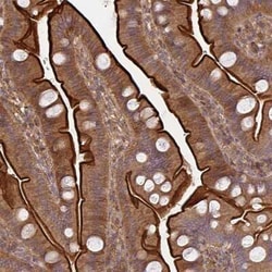 TEM Antibody, Novus Biologicals:Antibodies:Primary Antibodies