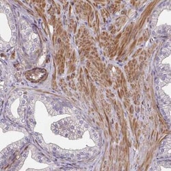 TEM Antibody, Novus Biologicals:Antibodies:Primary Antibodies