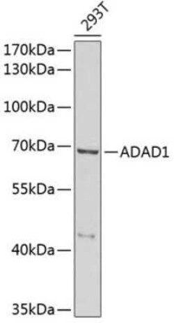 TENR Antibody - BSA Free, Novus Biologicals:Antibodies:Primary Antibodies
