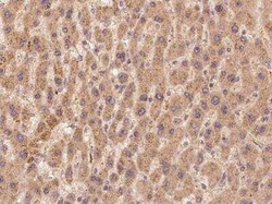TEP1 Antibody, Novus Biologicals 50 &mu;g; Unconjugated:Antibodies, Polyclonal