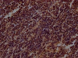 TERT Antibody (5C11), Novus Biologicals 100 &mu;g | Buy Online | Novus Biologicals | Fisher Scientific