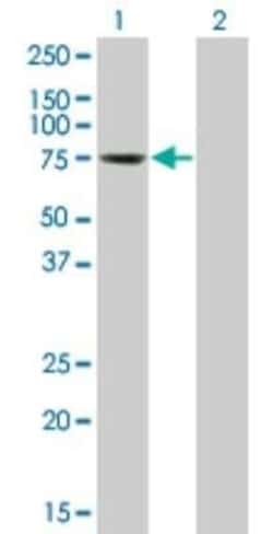 TESK2 Antibody (1A8), Novus Biologicals 0.1 mg | Buy Online | Novus Biologicals | Fisher Scientific