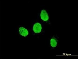 TESK2 Antibody (5G1), Novus Biologicals 0.1 mg | Buy Online | Novus Biologicals | Fisher Scientific
