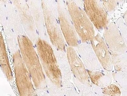 TET1 Antibody, Novus Biologicals 50 &mu;g, Unconjugated:Antibodies, Polyclonal