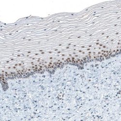 TET2 Antibody (CL6873), Novus Biologicals 25 &mu;L; TET2 Antibody; Unconjugated:Antibodies,