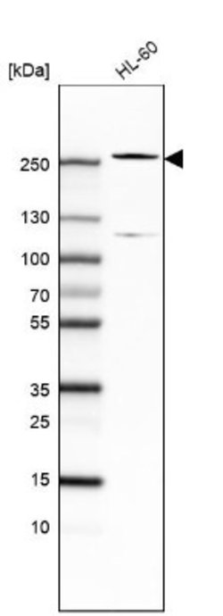 TET2 Antibody (CL6873), Novus Biologicals 25 &mu;L; TET2 Antibody; Unconjugated:Antibodies,