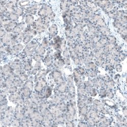 TET2 Antibody (CL6873), Novus Biologicals 25 &mu;L; TET2 Antibody; Unconjugated:Antibodies,