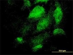 TEX13A Antibody (3B10), Novus Biologicals 0.1 mg | Buy Online | Novus Biologicals | Fisher Scientific
