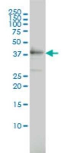 TEX13A Antibody (3B10), Novus Biologicals 0.1 mg | Buy Online | Novus Biologicals | Fisher Scientific