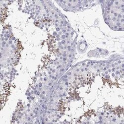 TEX13A Antibody, Novus Biologicals:Antibodies:Primary Antibodies