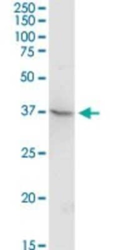 TEX13A Antibody, Novus Biologicals 0.1 mg | Buy Online | Novus Biologicals | Fisher Scientific