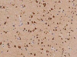 TEX13B Antibody, Novus Biologicals 100 &mu;g | Buy Online | Novus Biologicals | Fisher Scientific