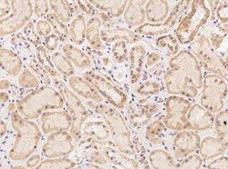 TEX13B Antibody, Novus Biologicals 100 &mu;g | Buy Online | Novus Biologicals | Fisher Scientific