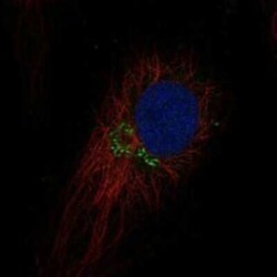 TEX26 Rabbit anti-Human, Polyclonal, Novus Biologicals 100 &mu;g | Buy Online | Novus Biologicals | Fisher Scientific